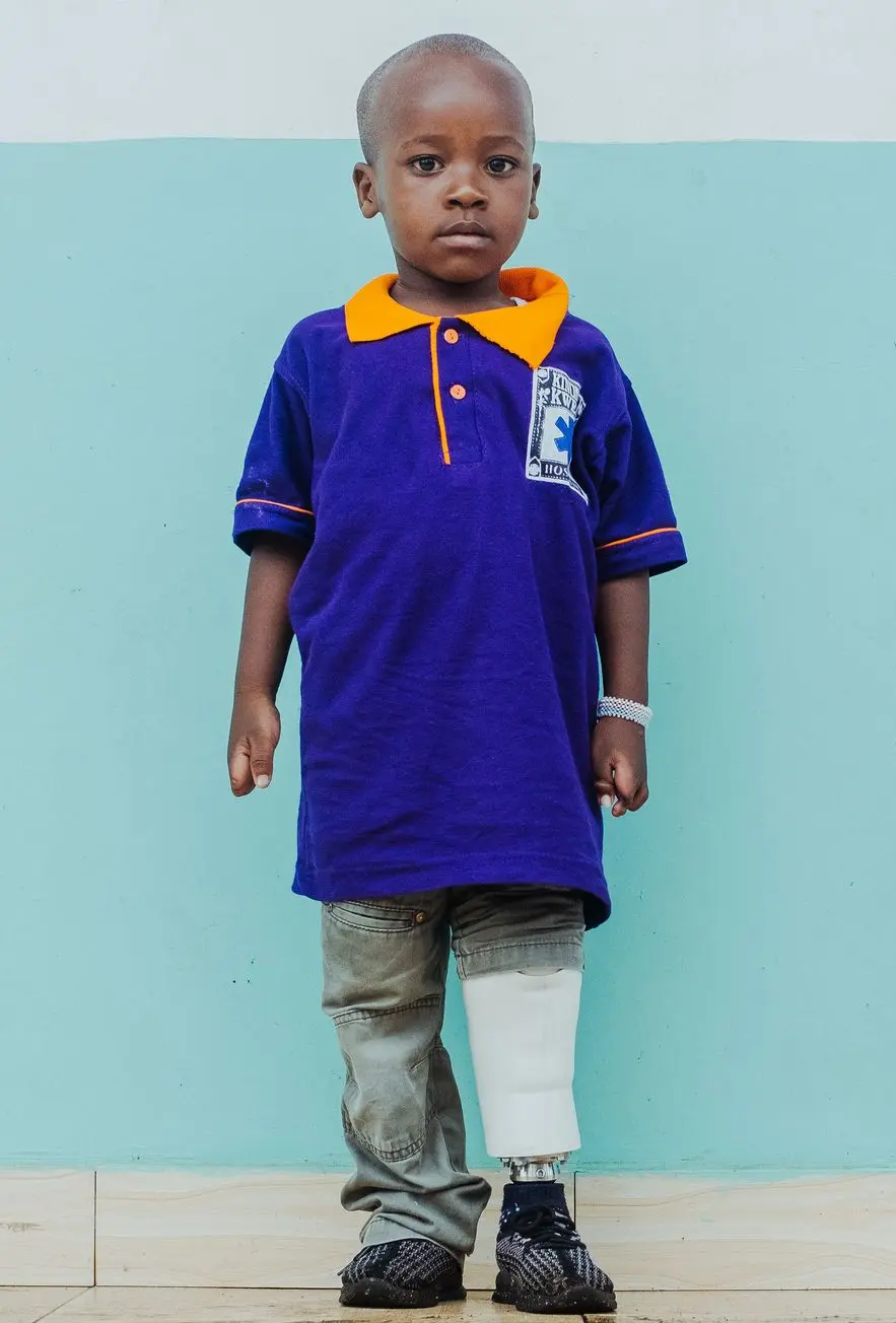 child with prosthetic ugani