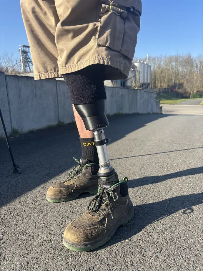Transtibial prosthetic